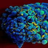 HIV-infected H9 t-cell