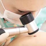 Dermatologist studies birthmark using dermatoscope