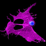 Microscopy image showing a stem cell-engineered CAR-NKT cell (blue) attacking a human solid tumor cell (magenta) against a black background