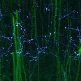Axons and neurons