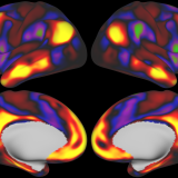 Image of brain functional connectivity that is being collected from the study.