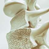 Osteoporosis in spine