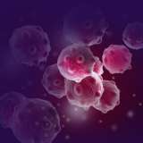 Cluster of cancer cells