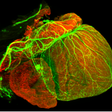 Electronic scan of the heart
