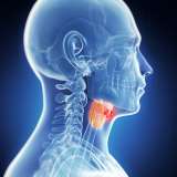 throat tumor illustration