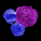 Image of stem cells attacking a human blood cancer cell