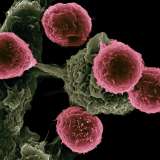 Immunotherapy attaching to cancer cells