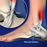 Video Library Podiatry