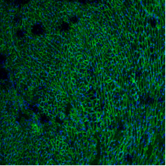 Fluorescent microscopy of muscle tissue showing restored dystrophin protein (green) after gene therapy in muscular dystrophy.