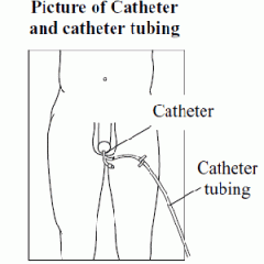 catheter