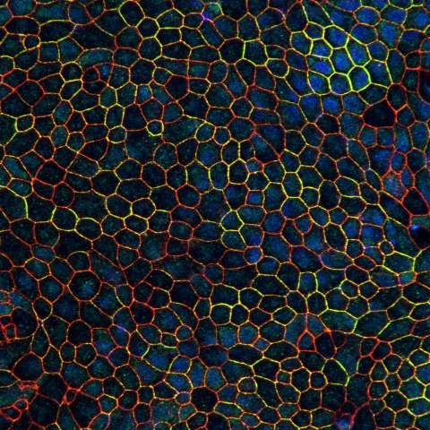 RPE Cells Differentiated From Stem Cells