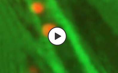 Phagosome Motility Video Thumbnail